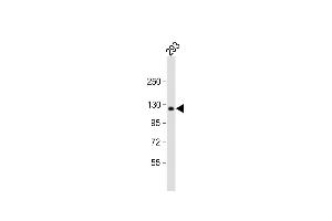 Anti-COL1A2 Antibody (N-term) at 1:1000 dilution + 293 whole cell lysate Lysates/proteins at 20 μg per lane. (COL1A2 antibody  (N-Term))