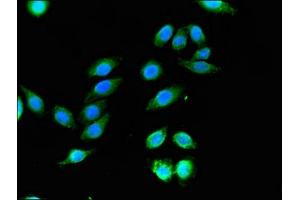Immunofluorescent analysis of A549 cells using ABIN7169222 at dilution of 1:100 and Alexa Fluor 488-congugated AffiniPure Goat Anti-Rabbit IgG(H+L) (WNK1 antibody  (AA 1-207))