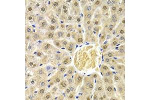 Immunohistochemistry of paraffin-embedded rat liver using RAD9A antibody.