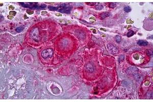 Anti-SERPINE1 / PAI-1 antibody IHC staining of human placenta, decidual cells.