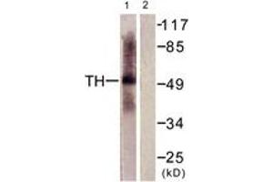 Western blot analysis of extracts from HepG2 cells, using Tryptophan Hydroxylase (Ab-58) Antibody. (Tryptophan Hydroxylase 1 antibody  (AA 26-75))