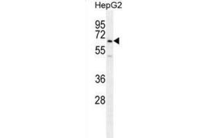 Western Blotting (WB) image for anti-Ubiquitin Family Domain Containing 1 (UBFD1) antibody (ABIN2996005) (UBFD1 antibody)