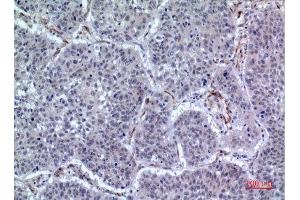 Immunohistochemistry (IHC) image for anti-Leukocyte Immunoglobulin-Like Receptor, Subfamily A (With TM Domain), Member 2 (LILRA2) (Internal Region) antibody (ABIN6281107)