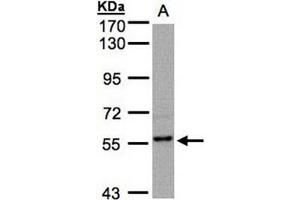 AP31129PU-N RGS14 antibody staining of MOLT4 (Lane A) whole cell lysate (30 µg) at 1/500 dilution, 7. (RGS14 antibody  (AA 504-516))