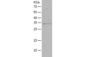 KRIT1 Protein (AA 203-529) (His tag)