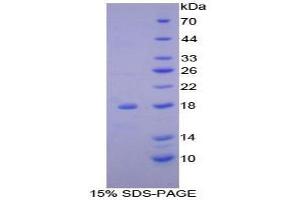 SDS-PAGE (SDS) image for NADH Dehydrogenase (Ubiquinone) 1, alpha/beta Subcomplex, 1, 8kDa (NDUFAB1) protein (ABIN3008113)