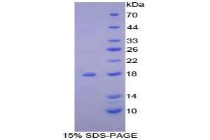SDS-PAGE analysis of Mouse ACP Protein. (NDUFAB1 Protein)