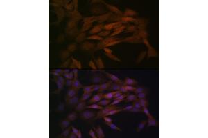 Immunofluorescence analysis of NIH-3T3 cells using MEK3 Rabbit mAb (ABIN1682965, ABIN3017630, ABIN3017631 and ABIN7101512) at dilution of 1:100 (40x lens). (MAP2K3 antibody)