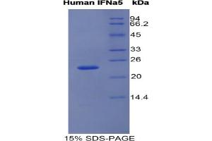 SDS-PAGE analysis of Human Interferon alpha 5 Protein. (IFNA5 Protein)