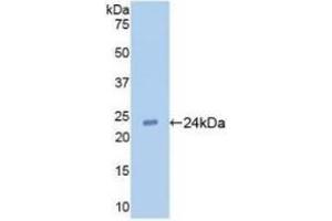 Detection of Recombinant TLR2, Human using Monoclonal Antibody to Toll Like Receptor 2 (TLR2) (TLR2 antibody  (AA 47-245))
