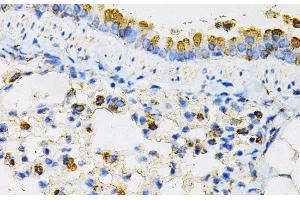Immunohistochemistry of paraffin-embedded Mouse lung using NPC2 Polyclonal Antibody at dilution of 1:100 (40x lens).