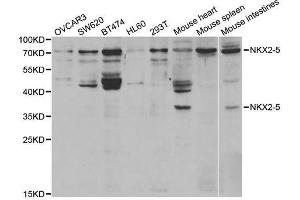 Western Blotting (WB) image for anti-NK2 Homeobox 5 (NKX2-5) antibody (ABIN1876852) (NK2 Homeobox 5 antibody)