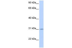 WB Suggested Anti-ZNF146 Antibody Titration:  0. (ZNF146 antibody  (Middle Region))