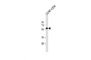 Western Blot at 1:1000 dilution + CCRF-CEM whole cell lysate Lysates/proteins at 20 ug per lane.