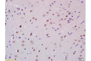 Formalin-fixed and paraffin embedded rat brain tissue labeled with Anti-PCGF1 Polyclonal Antibody, Unconjugated (ABIN713951) at 1:200 followed by conjugation to the secondary antibody and DAB staining (PCGF1 antibody  (AA 121-220))