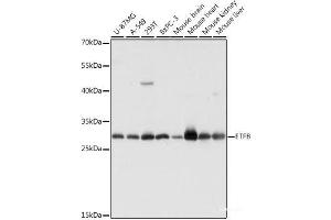 ETFB antibody