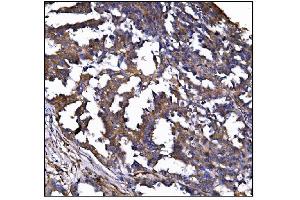IHC analysis of POGLUT1 using anti-POGLUT1 antibody (ABIN7602910).