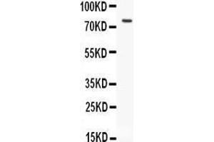 Anti-hCG receptor antibody, Western blotting All lanes: Anti hCG receptor  at 0. (LHCGR antibody  (N-Term))