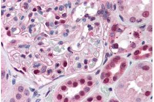 Human Kidney: Formalin-Fixed, Paraffin-Embedded (FFPE) (PAX7 antibody  (AA 411-521))