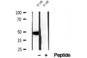 Western blot analysis of extracts of HT-1080 cells, using SMCR7/MID49 antibody. (SMCR7 antibody)