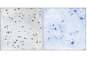 Immunohistochemistry analysis of paraffin-embedded human brain tissue using DIL-2 antibody. (TPX2 antibody  (Internal Region))