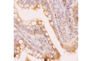 Anti-MRP4 Picoband antibody,  IHC(P): Rat Intestine Tissue (ABCC4 antibody  (AA 1-370))