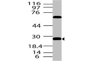 Image no. 1 for anti-Dickkopf Homolog 1 (DKK1) antibody (ABIN5027705) (DKK1 antibody)