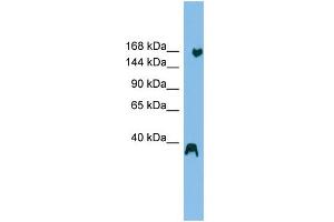 WB Suggested Anti-ZNF294 Antibody Titration: 0. (RNF160 antibody  (N-Term))