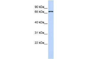 WB Suggested Anti-ZNF778 Antibody Titration:  0.