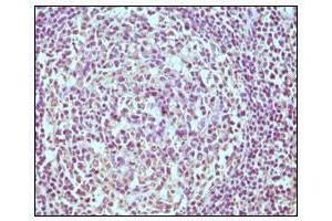 Immunohistochemical analysis of paraffin-embedded human normal lymph node, showing cytoplasmic localization using CD19 antibody with DAB staining. (CD19 antibody)