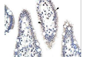 Image no. 1 for anti-Unconventional SNARE in The ER 1 Homolog (Use1) (N-Term) antibody (ABIN6736183) (Use1 antibody  (N-Term))