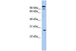 WB Suggested Anti-VDAC3 Antibody Titration:  0. (VDAC3 antibody  (N-Term))