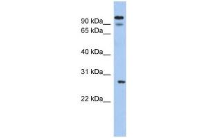 WB Suggested Anti-VDAC3 Antibody Titration:  0.