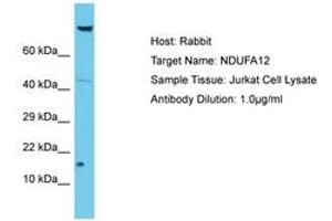 Image no. 1 for anti-NADH Dehydrogenase (Ubiquinone) 1 alpha Subcomplex, 12 (NDUFA12) (AA 6-55) antibody (ABIN6750643) (NDUFA12 antibody  (AA 6-55))
