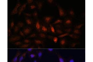 Immunofluorescence (IF) image for anti-Proteasome Subunit alpha  7 (PSMA7) antibody (ABIN7260948)