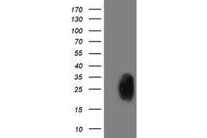 Western Blotting (WB) image for anti-phosphoglycerate Mutase 2 (Muscle) (PGAM2) antibody (ABIN1500173) (PGAM2 antibody)
