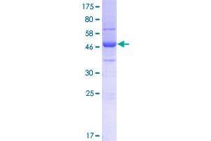 SFI1 Protein (AA 1-209) (GST tag)