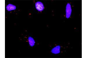 Proximity Ligation Analysis of protein-protein interactions between RUNX1T1 and HDAC1. (RUNX1T1 antibody  (AA 1-577))