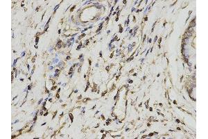 Immunohistochemistry (IHC) image for anti-Proteasome (Prosome, Macropain) Activator Subunit 1 (PA28 Alpha) (PSME1) antibody (ABIN1876546) (PSME1 antibody)