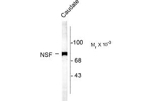 Western blots of rat caudate lysate showing specific labeling of the ~75k NSF protein. (NSF antibody  (C-Term))