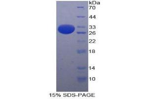 SDS-PAGE (SDS) image for Integrin, alpha E (Antigen CD103, Human Mucosal Lymphocyte Antigen 1, alpha Polypeptide) (ITGAE) (AA 671-917) protein (His tag) (ABIN2125324) (CD103 Protein (AA 671-917) (His tag))