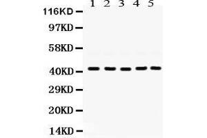 Western Blotting (WB) image for anti-Guanine Nucleotide Binding Protein (G Protein), Q Polypeptide (GNAQ) (AA 102-138), (N-Term) antibody (ABIN3043833) (GNAQ antibody  (N-Term))