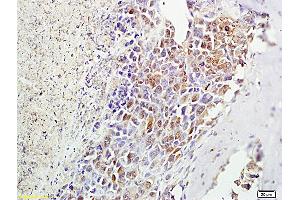 Formalin-fixed and paraffin embedded mouse foot tumor labeled with Anti-? (MSH alpha (AA 138-150) antibody)