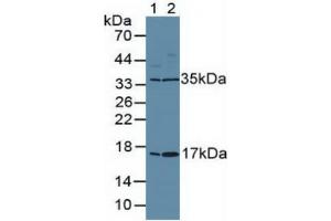 Rabbit Capture antibody from the kit in WB with Positive Control: Human placenta tissue. (Ki-67 ELISA Kit)