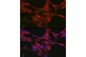 Immunofluorescence analysis of C6 cells using CDC42 Rabbit pAb (ABIN3021670, ABIN3021671, ABIN3021672 and ABIN6215499) at dilution of 1:50 (40x lens).