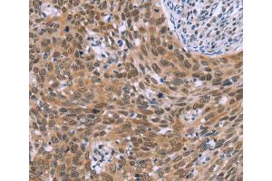 Immunohistochemistry (IHC) image for anti-Glyoxylate Reductase 1 Homolog (GLYR1) antibody (ABIN2434708) (GLYR1 antibody)