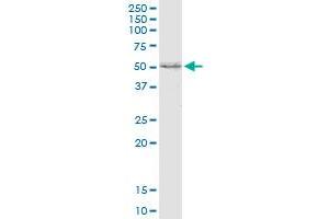 SCARB2 polyclonal antibody (A01). (SCARB2 antibody  (AA 339-437))