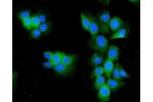 IF analysis of Aldolase/ALDOA using anti- Aldolase/ALDOA antibody (ABIN7601907). (ALDOA antibody  (AA 50-364))