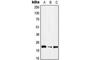 Western blot analysis of IFN alpha 1 expression in HEK293T (A), NIH3T3 (B), H9C2 (C) whole cell lysates. (IFNA1 antibody  (Center))