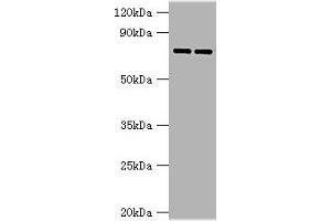 Western blot All lanes: AGUSB antibody at 2 μg/mL Lane 1: HL60 whole cell lysate Lane 2: HepG2 whole cell lysate Secondary Goat polyclonal to rabbit IgG at 1/10000 dilution Predicted band size: 75, 70, 59 kDa Observed band size: 75 kDa (Glucuronidase beta antibody  (AA 382-651))